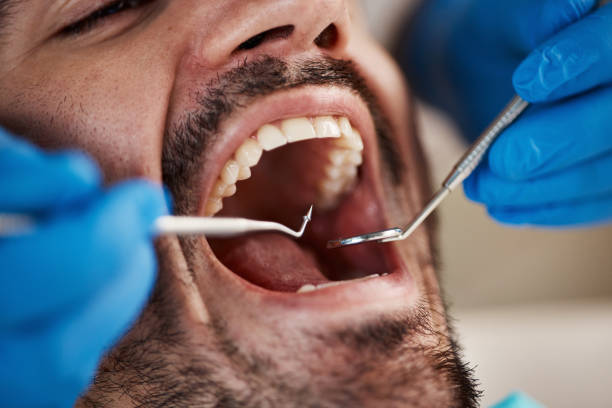 Best Urgent Care for Lost Fillings or Crowns in West Brownsville, PA