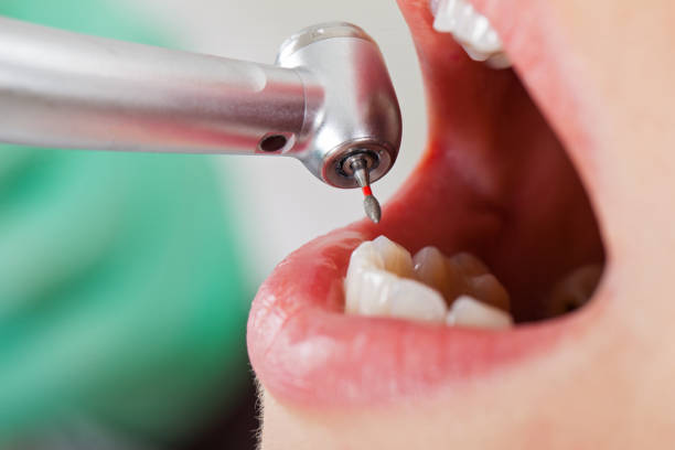 Best Pediatric Emergency Dentist in West Brownsville, PA